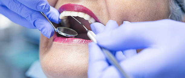 Best Chipped Tooth Repair Near Me  in Seabrook, TX